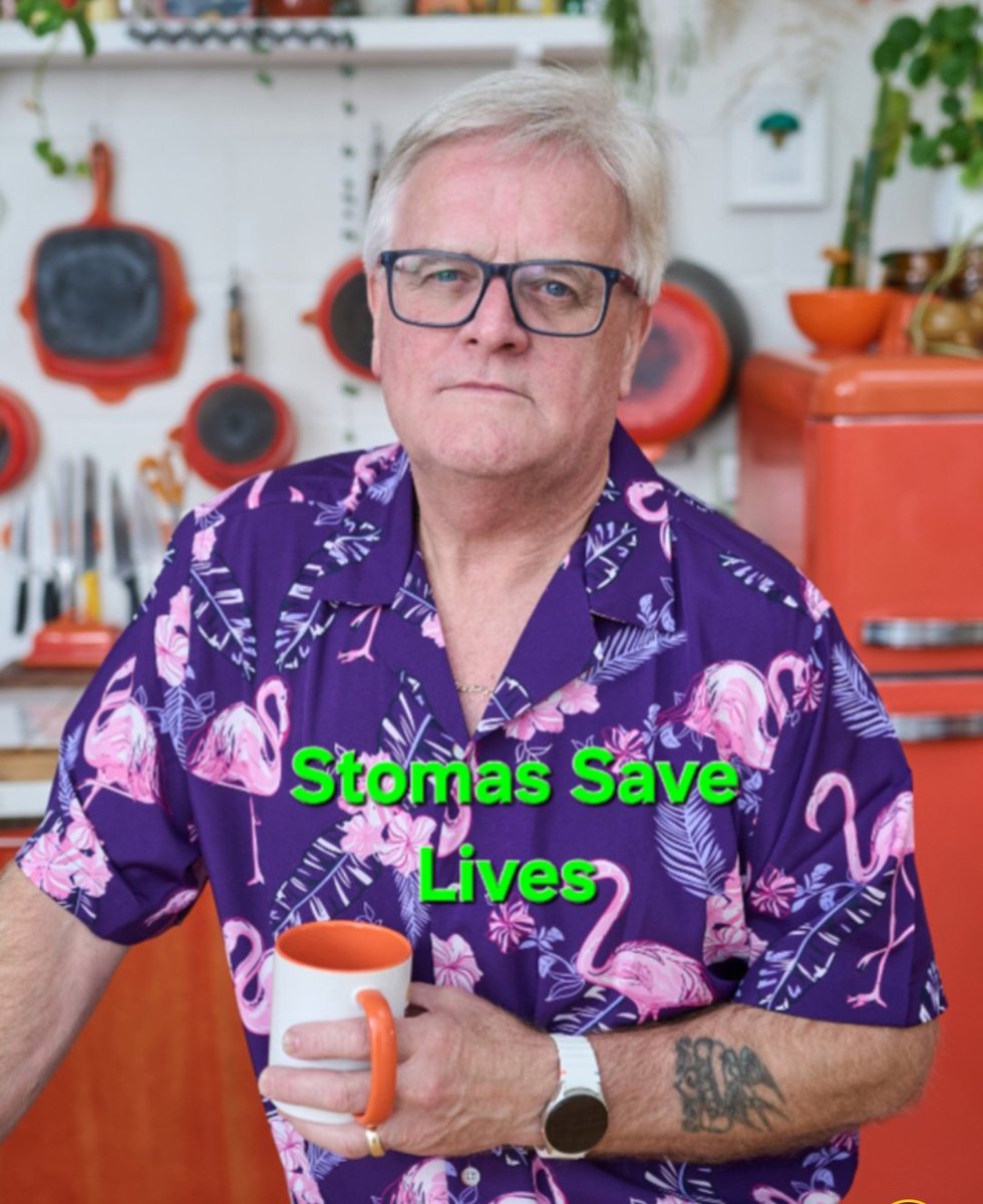 Losing my bowel 13 years ago to #ulcerativecolitis and gaining a stoma for life,  made me determined to show the world 🌎 this is just a small thing to deal with in the grand scale of life and the problems we encounter. My stoma gave me a second chance to live.