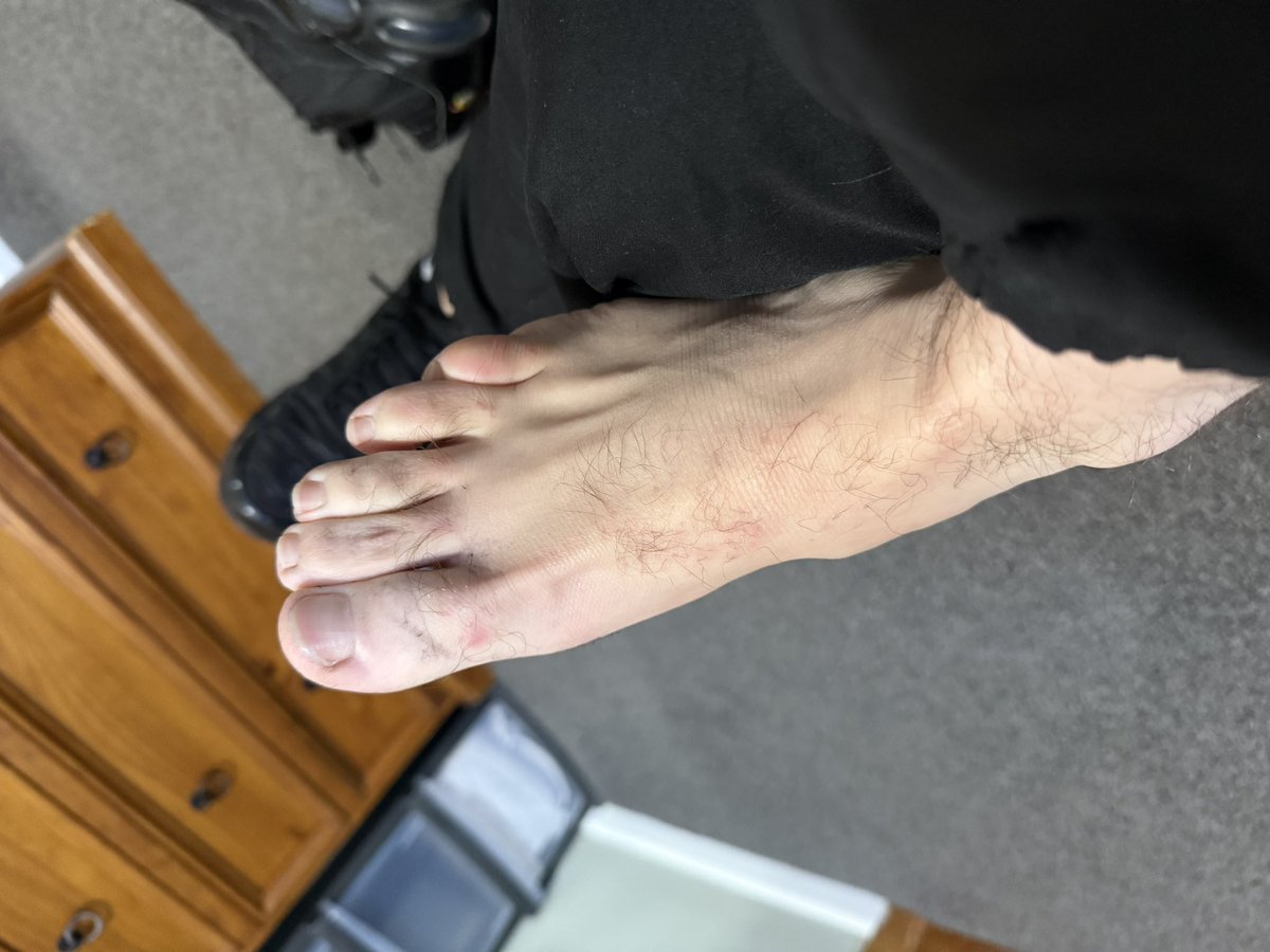 MASTER KING Josh👑😈 tweet media