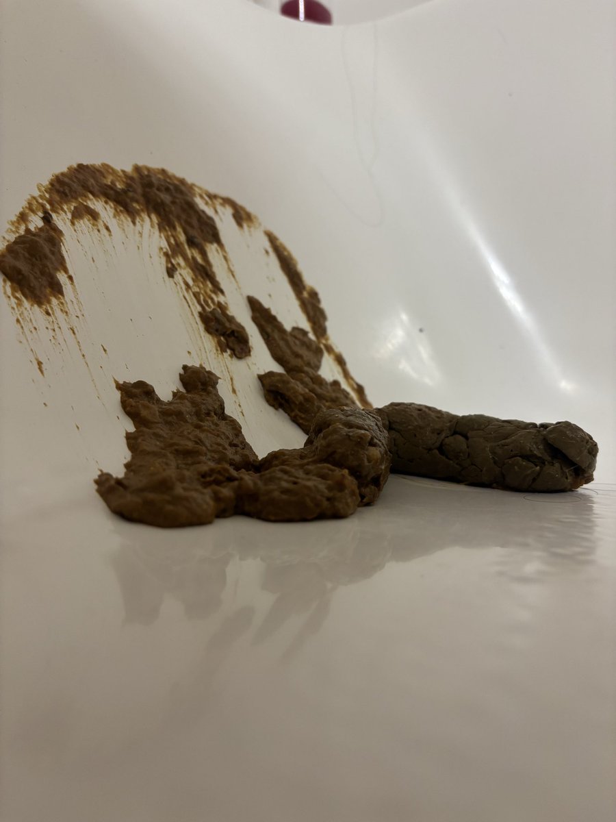 filth102's tweet photo. Splat #scat https://t.co/0aZFSLkbnW