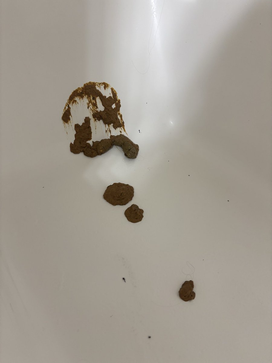 filth102's tweet photo. Splat #scat https://t.co/0aZFSLkbnW