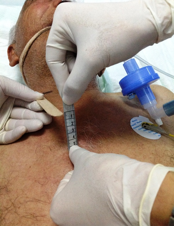 NephroPOCUS tweet media