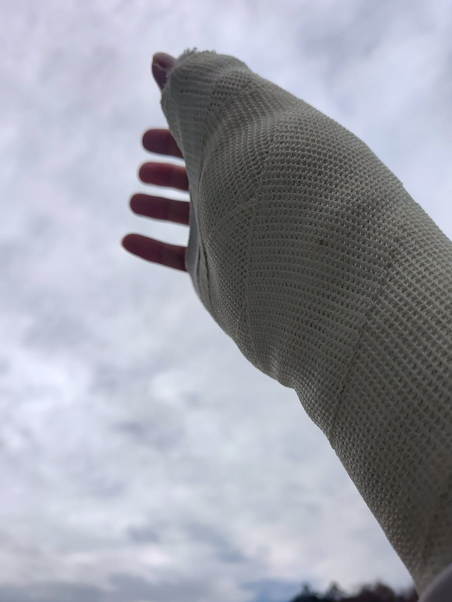 Kota_webcoder's tweet image. 6週間を共に過ごしたギプスとも今日でお別れです…！
実に長い1ヶ月半でした😊