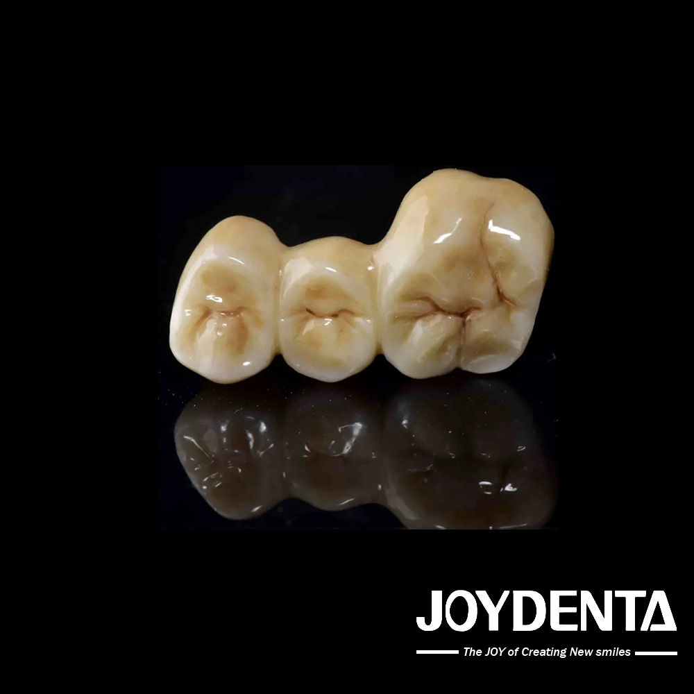 joydentalab's tweet image. Just finished a clean 3-unit zirconia bridge—nice margins, nice shade, nice fit.
Simple work, but it feels good when everything lines up just right.
Looking for a reliable lab partner?
🌐 joydentalab.com
#DentalLab #ZirconiaBridge #3UnitBridge #DentalTech #Prosthodontics