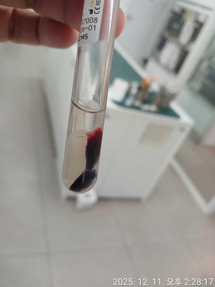 소피 안 좋은 소식입니다... 수술을 위해 피검사를 했는데 빈혈 수치가 심각하게 낮게 나와서 수혈을 받아야할 것 같아요.... 수혈을 받게 될 경우 예상하던 금액보다 수술비가 100만원 가량 더 나오게 될 것 같습니다....ㅠㅠ 소피가 잘 이겨낼 수 있도록 관심가져주심 감사합니다.