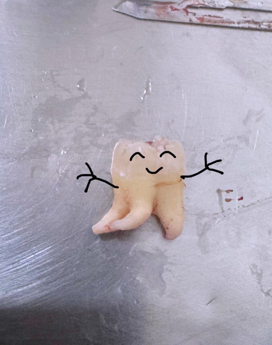 เจอแล้วไง ฟันวิ่งสุดน่ารัก🦷 แต่หมอเครียดบักคัก 🙂‍↕️