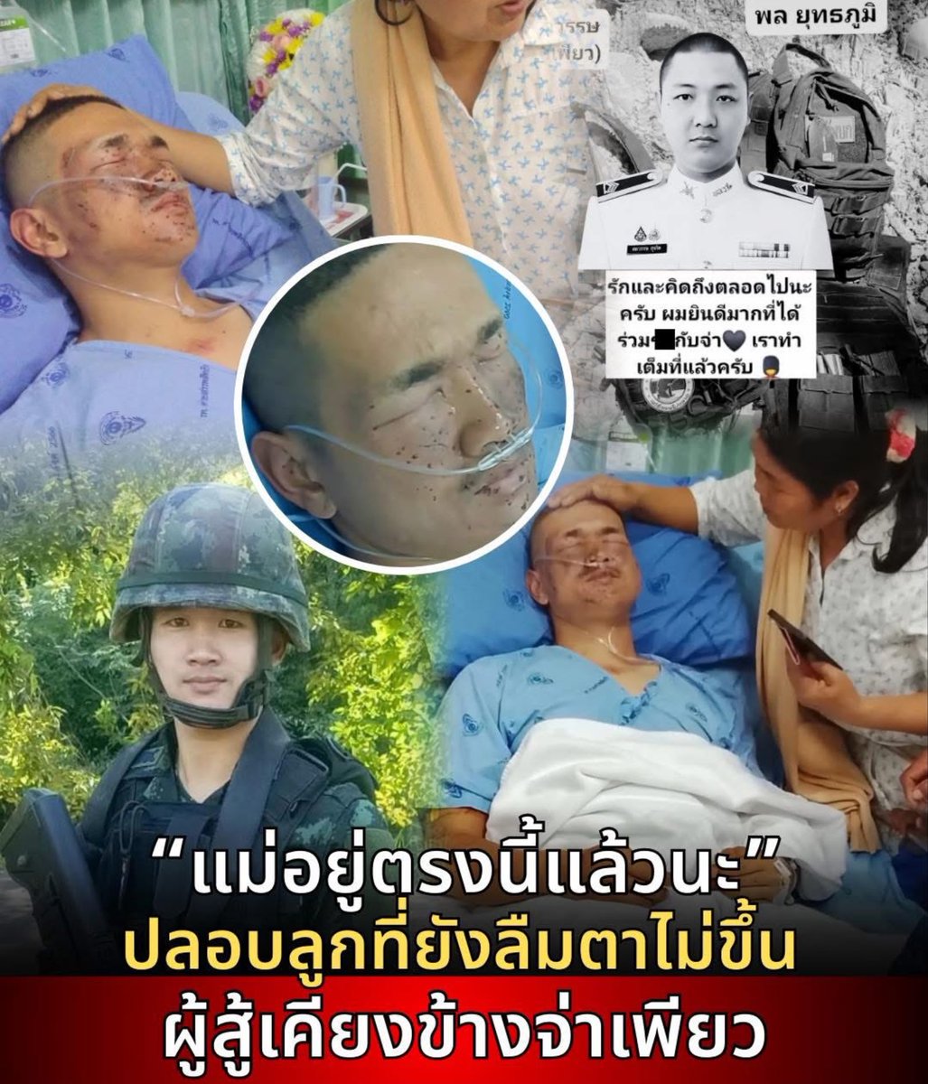 Kawaaii13's tweet photo. ส่งกำลังใจให้ทหารแนวหน้าทุกคน ✨🤍🤍✨ พวกท่านคือผู้เสียสละเพื่อปกป้องประเทศชาติและแผ่นดินไทย 🇹🇭🙏🏻

น้ำตาของคนเป็นแม่…เป็นห่วงลูกสุดหัวใจ  ตาลูกยังลืมไม่ขึ้น โดนสเก๊ทบางอย่างจากเหตุชายแดน 

พลยุทธภูมิผู้สู้เคียงข้าง”จ่าเพียว”แม้วันนี้ตาจะยังลืมไม่ขึ้น บวมหนัก
แต่เขารับรู้แล้วว่ารุ่นพี่ผู้กล้าจ.ส.อ. ศตวรรษ สุจริต (จ่าเพียว)ได้จากไปแล้ว 

คำพูดของทหารยุทธภูมิไว้อาลัยต่อรุ่นพี่ว่า
“รักและคิดถึงตลอดไปนะครับ ผมยินดีมากที่ได้ร่วมเคียงข้างกับจ่า เราทำเต็มที่แล้วครับ”สะท้อนถึงความผูกพันและหัวใจของทหารสองรุ่นที่สู้ไปด้วยกัน

วันนี้ พลยุทธภูมิได้ปลอดภัยแล้ว ถึงยังหนักอยู่ แม่อยู่ตรงนี้แล้ว… เคียงข้างลูกต่อไม่ว่าจะเกิดอะไรขึ้นในสายตาของแม่ ลูกชายคนนี้คือความกล้าหาญที่ยิ่งใหญ่เสมอ

 #กองกําลังบูรพา #ชายแดนไทยกัมพูชา
 #ปราสาทตาควาย #ไทยนี้รักสงบแต่ถึงรบไม่ขลาด 
#กัมพูชายิงก่อน