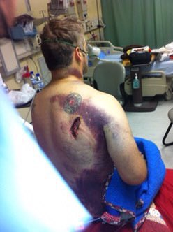 Chuck_Ritter92's tweet photo. I’ve been the recipient of 4 x 7.62 x 54mm rounds. Slightly larger than 30-06, and just negligibly slower. Result was I had no exit wound the first go around from 25m away when he got me. I bleed out and crashed on the operating table a few times and had to get 13 units of blood. Year after I took the same caliber round to the brought hand and it blew out many of the bones. 

Next question sit.