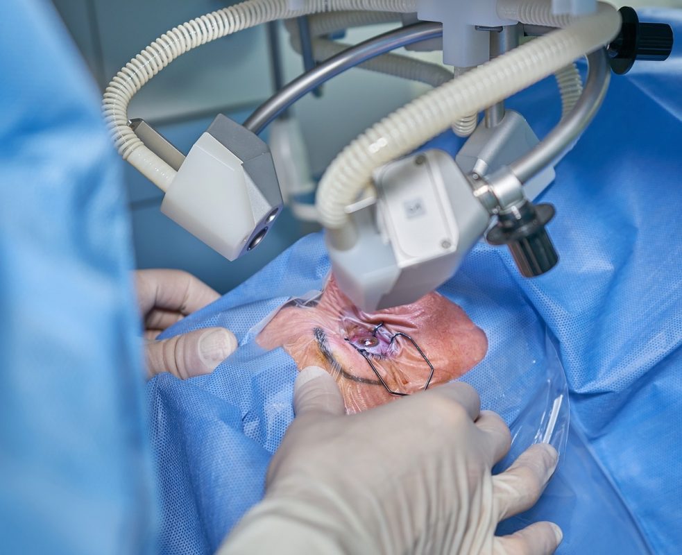 surgerygenesis's tweet photo. Cataract surgery removes the eye’s cloudy lens and replaces it with a clear artificial lens, restoring vision, enhancing clarity, and improving daily visual activities safely.

#CataractSurgery #EyeHealth #VisionCare #MedicalInnovation #Ophthalmology #HealthyEyes https://t.co/CHzStoIEdX