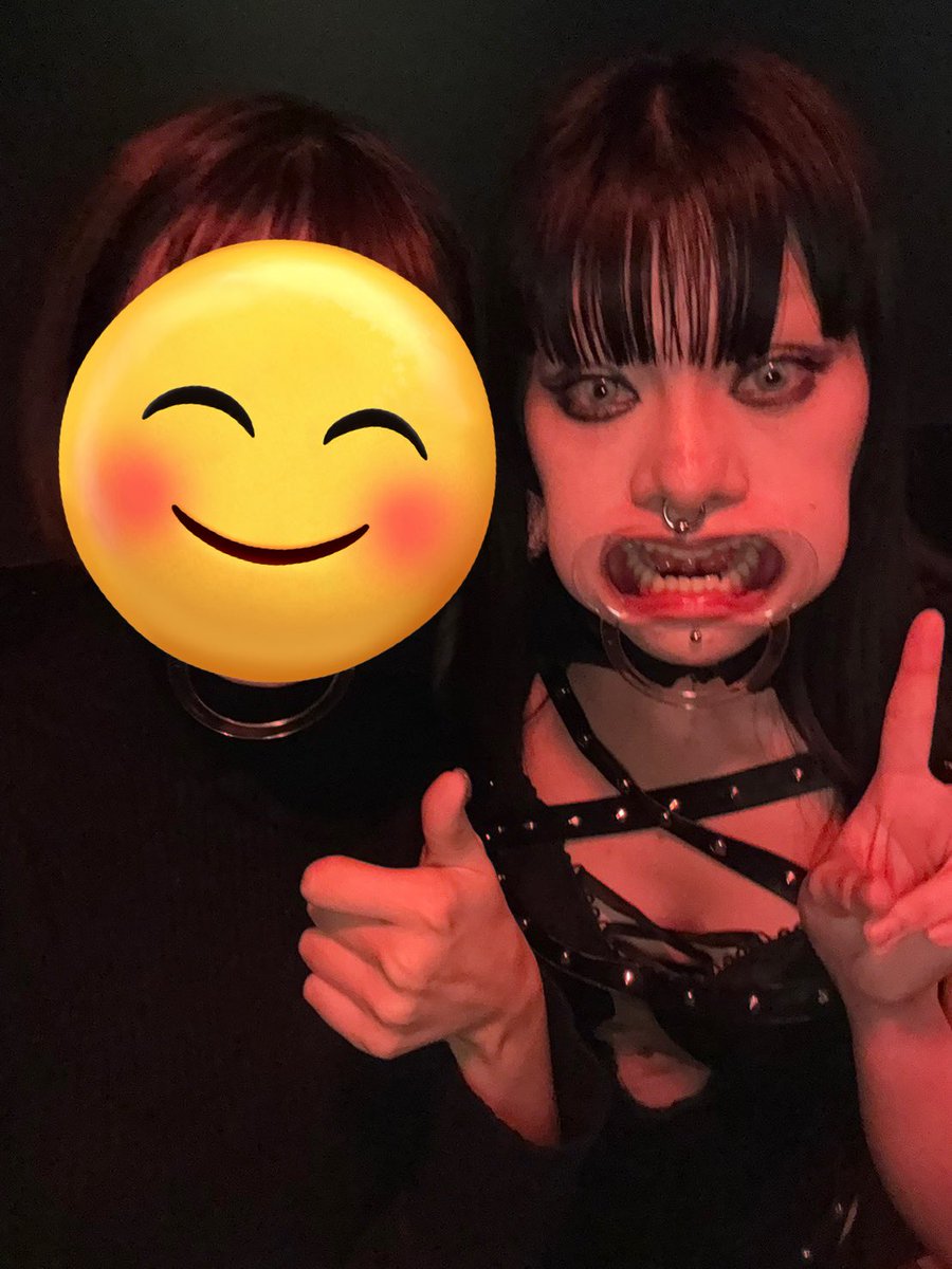 本日アマル20時から出勤です

昨日リリカ氏と開口器で遊んだ写真

カートゥーンアニメみたいな口でオモロすぎるwww

みんなも開口器で遊ぼ〜！

 #amarcord_tk