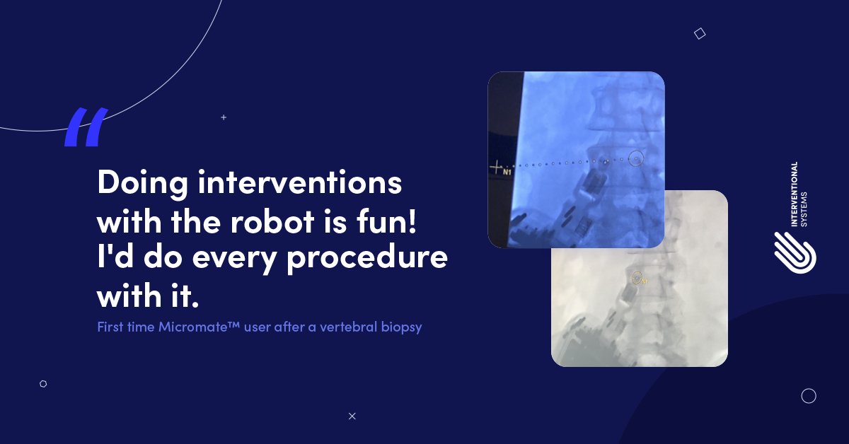 'Tis the season for pleasant surprises in the IR suite.

When a first-time user thinks #Micromate™ is easy (and fun!) to use, you know the technology is working as it should. 

#ValueBasedRobotics #HealthcareInnovation #InterventionalRadiology #SurgicalRobotics