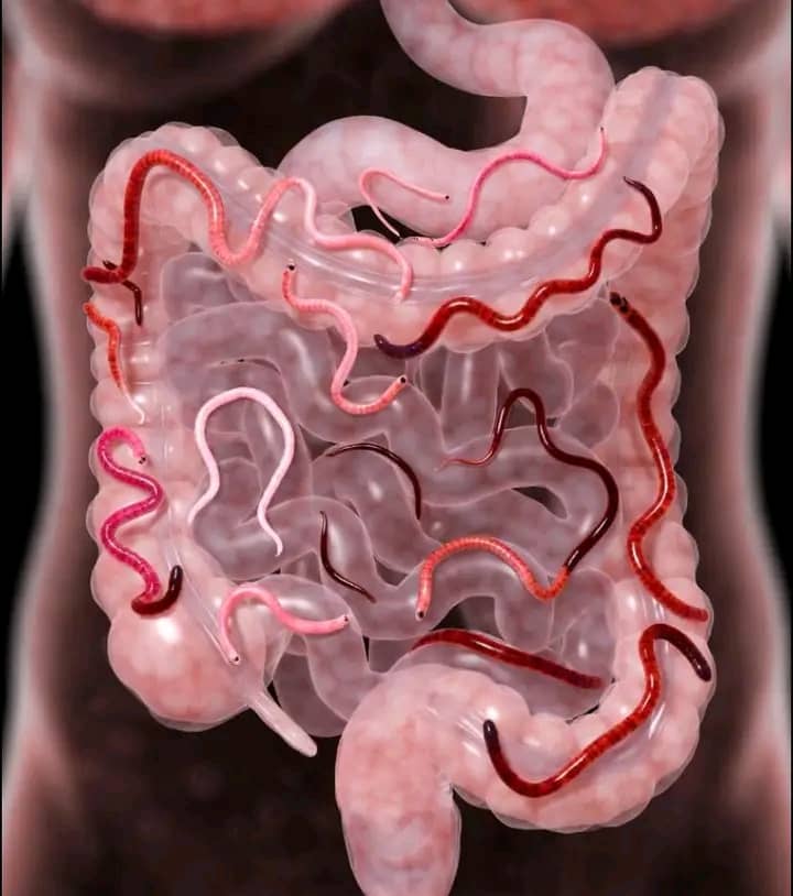 HEALTH BENEFITS OF DEWORMING

Many people carry worms for months without knowing, and the body keeps sending small signs that something is wrong. 

Clearing these worms can transform your energy, your appetite, your skin, and your overall health more than you expect.