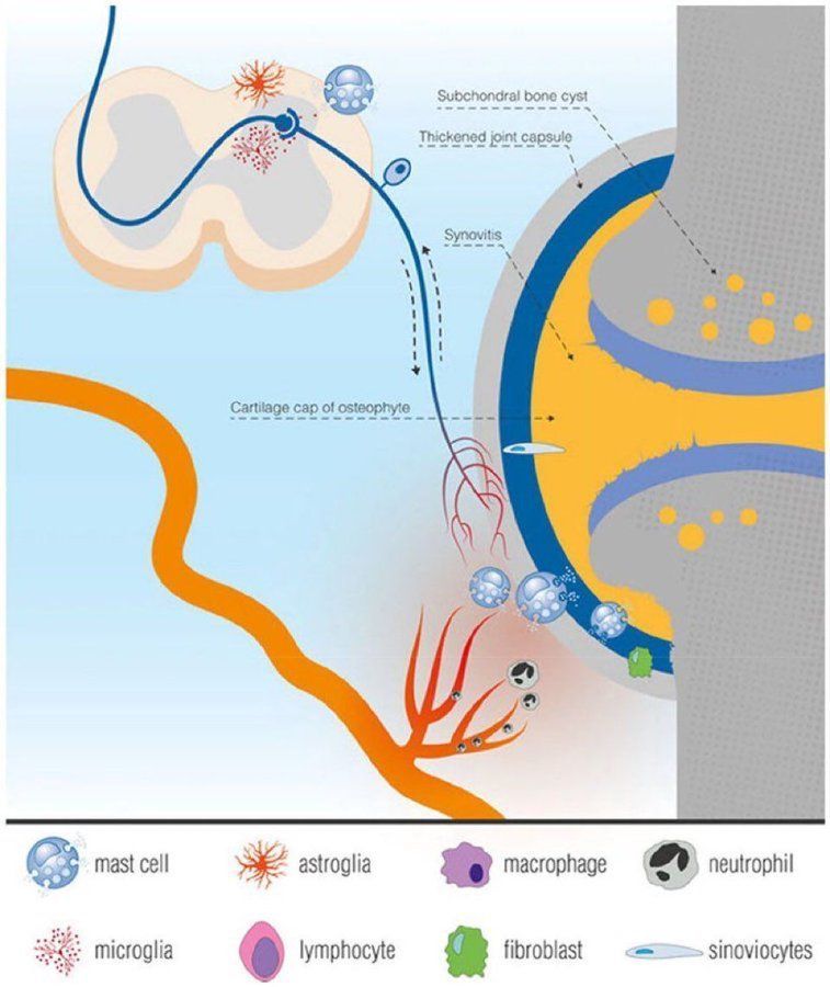 Pathophysiology of musculoskeletal pain

Contribution of mast cells and microglia to degenerative joint diseases (DJD) and neuro-inflammation

journals.sagepub.com/doi/10.1177/17…