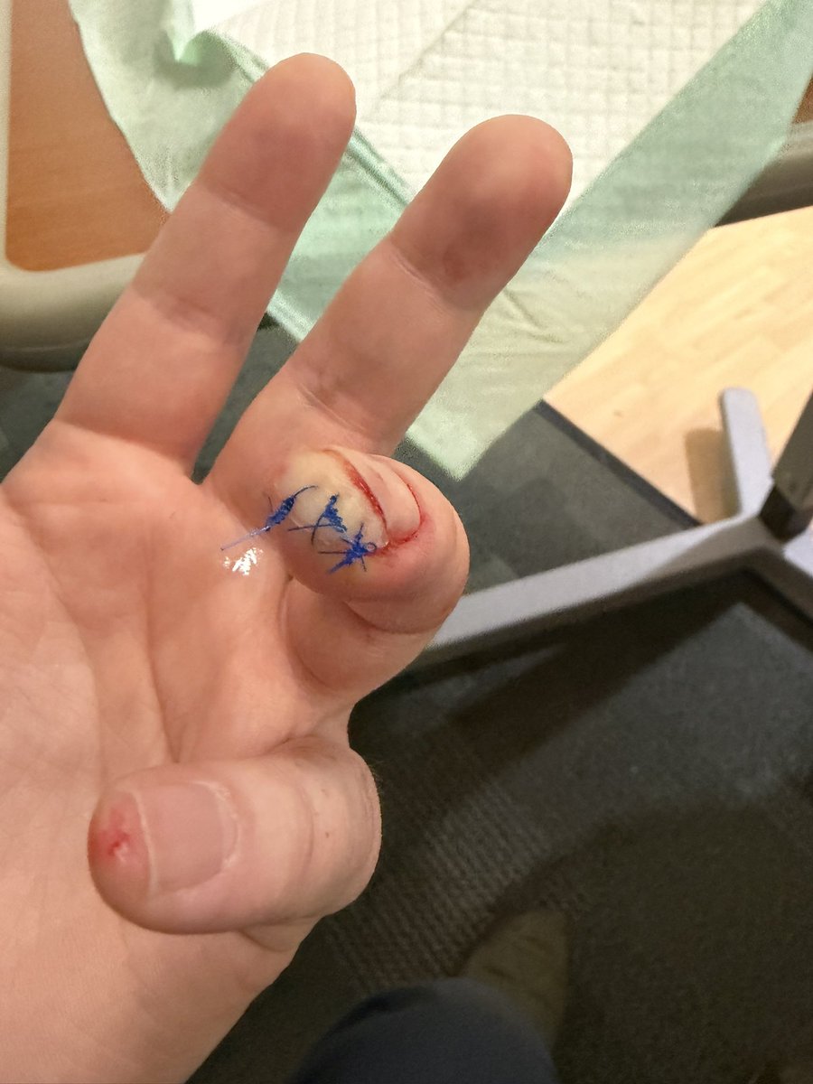 fuzzyharmonica's tweet photo. @MavProject21 I was installing a new outlet for a safe that was coming in, and was trimming the sheathing off some Romex when, out of nowhere, I was cutting my finger instead! https://t.co/vwBLxY1hHm