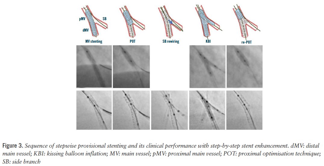 EuroIntervention tweet media