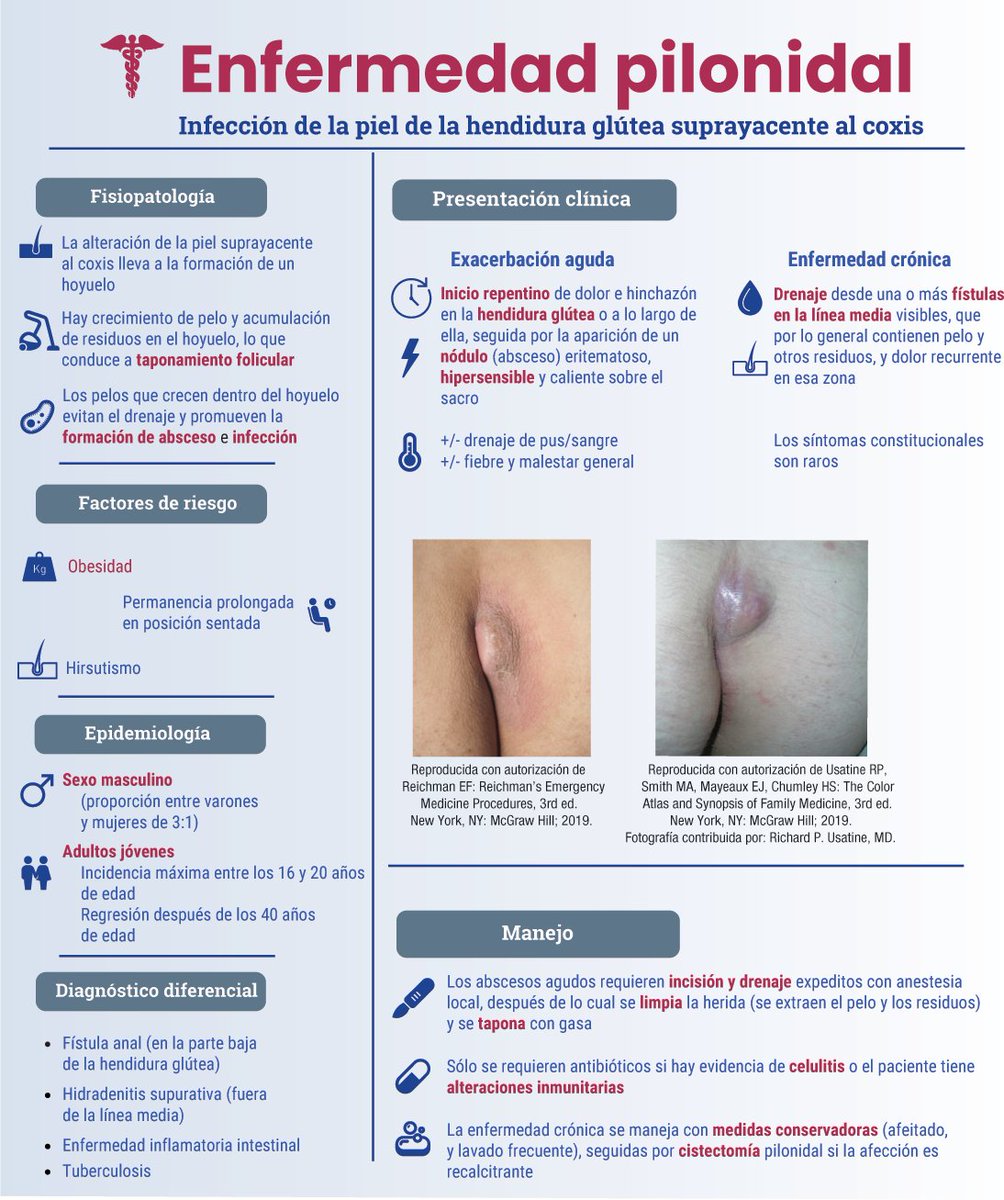 ENARM_intensivo's tweet photo. 💢ENFERMEDAD  PILONIDAL

#ENARM_INTENSIVO #ESTUDIA_MEDICINA 
📲https://t.co/7BMaoPHhyY https://t.co/YRUIxG1q98