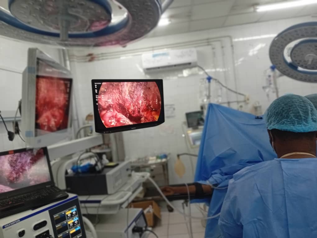 GSBeninHub's tweet photo. Day 2: Left total nephrectomy.
@NIHRglobal @lawaniismail @farm   @taka360 @CovalicBokossa https://t.co/RoDuUS5bJ3
