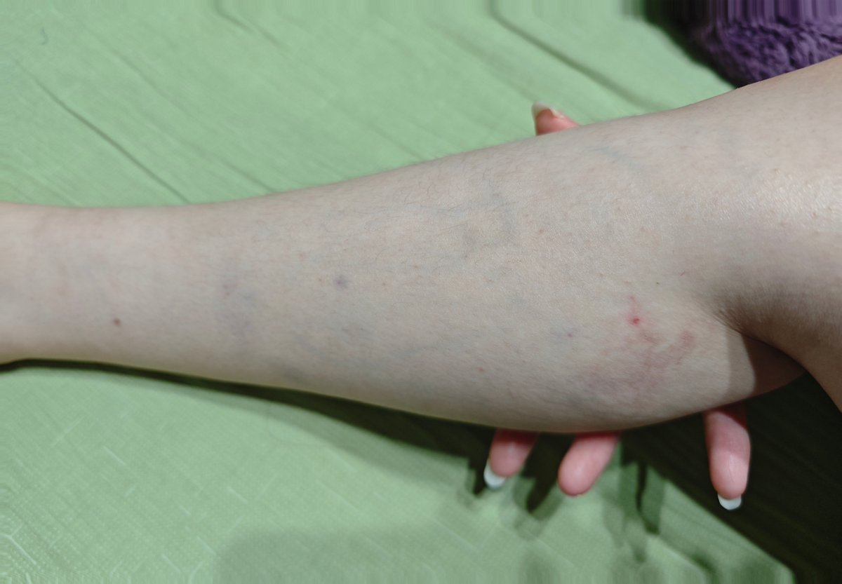 冬天真的很不适合玩绳了
本来一周消的半个多月还在
半个月消得要不知道多久