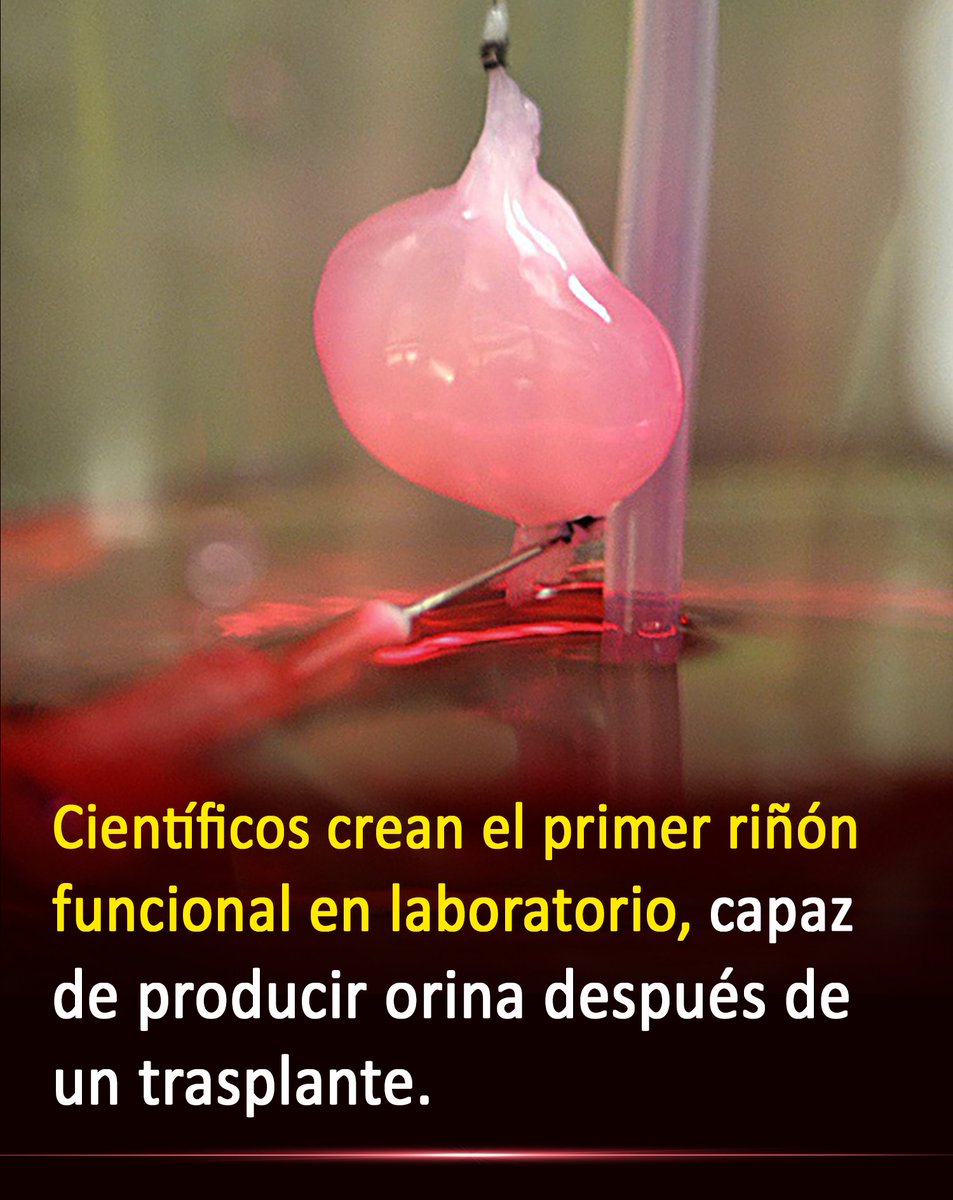 Lo que parecía imposible ya es real: un riñón creado en laboratorio logró producir orina después de ser trasplantado. Un avance que podría transformar el futuro de los trasplantes y salvar millones de vidas.

Mayor info: wp.me/p9eYmY-9rW