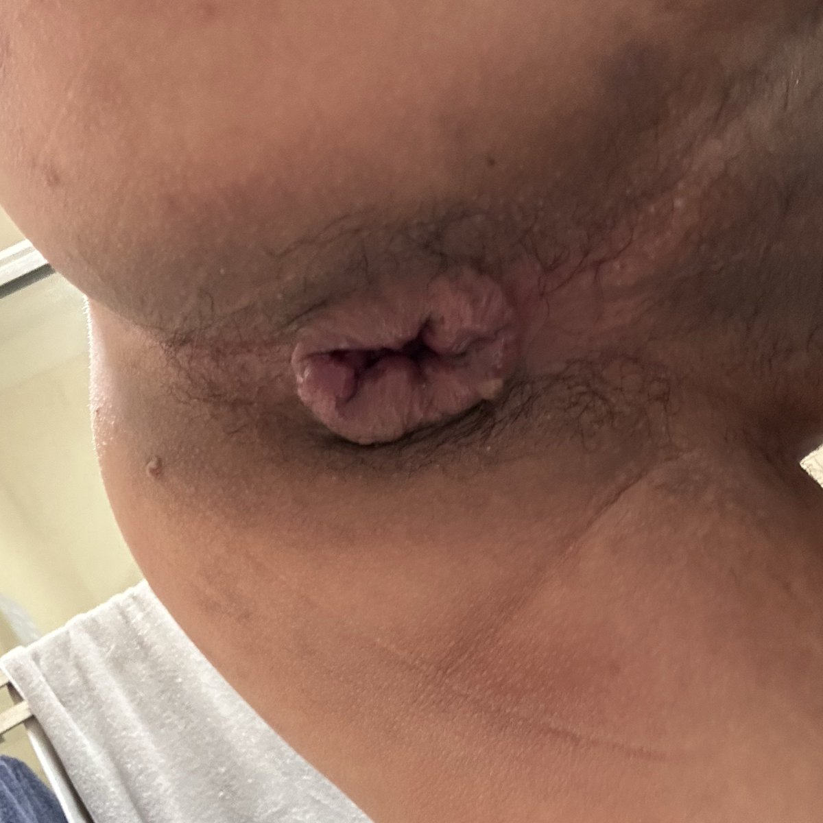 Rồi xong… 

#mancunt