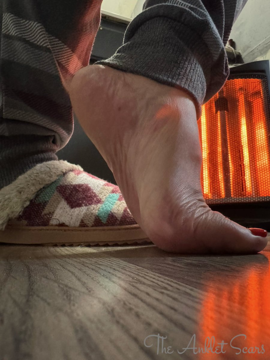 TheAnkletScars's tweet photo. @HSoless https://t.co/1mp18Jh4Um
