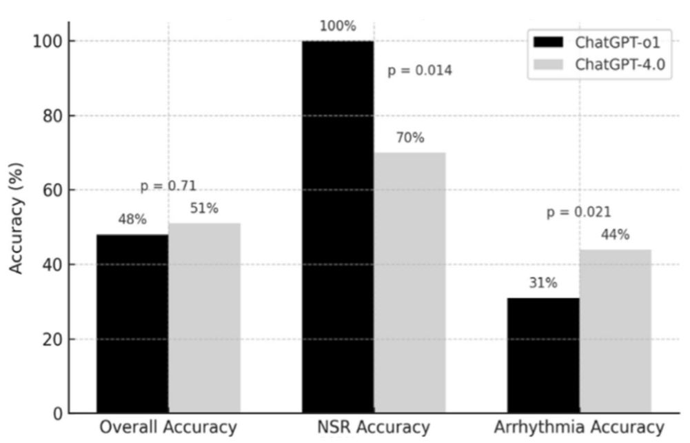 JournalGIM's tweet photo. How well can @ChatGPTapp read an ECG?

This #JGIM #ConciseResearchReport by @DrJGoldberger from @umiamimedicine finds that both models (GPT-4o &amp; o1) frequently miss diagnoses

Promising tech but far from replacing expert review

Read the 🆓 full-text ⬇️:
https://t.co/IgF5w65Bh8 https://t.co/VqhFMDdsWo