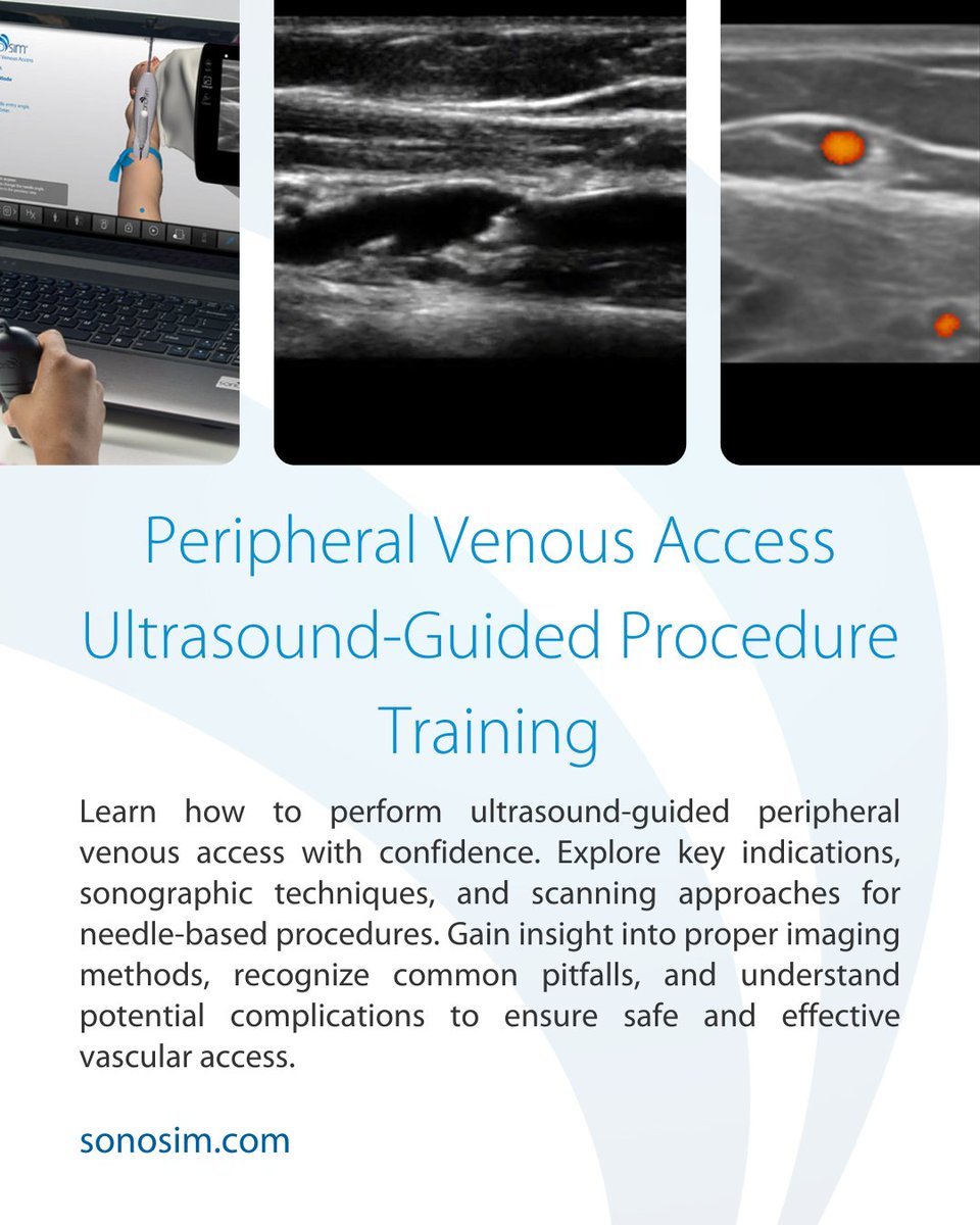 SonoSim, Inc tweet media