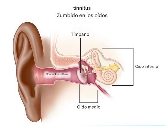 VallenPrimeX's tweet photo. Te han mentido.

Ese zumbido en los oídos no es normal.

Es una señal de ADVERTENCIA de que tu sistema nervioso se está rompiendo down.

Esto es lo que realmente SUCEDE dentro de tu cerebro (y cómo silenciarlo): 🧵 https://t.co/8PsATAO5E3