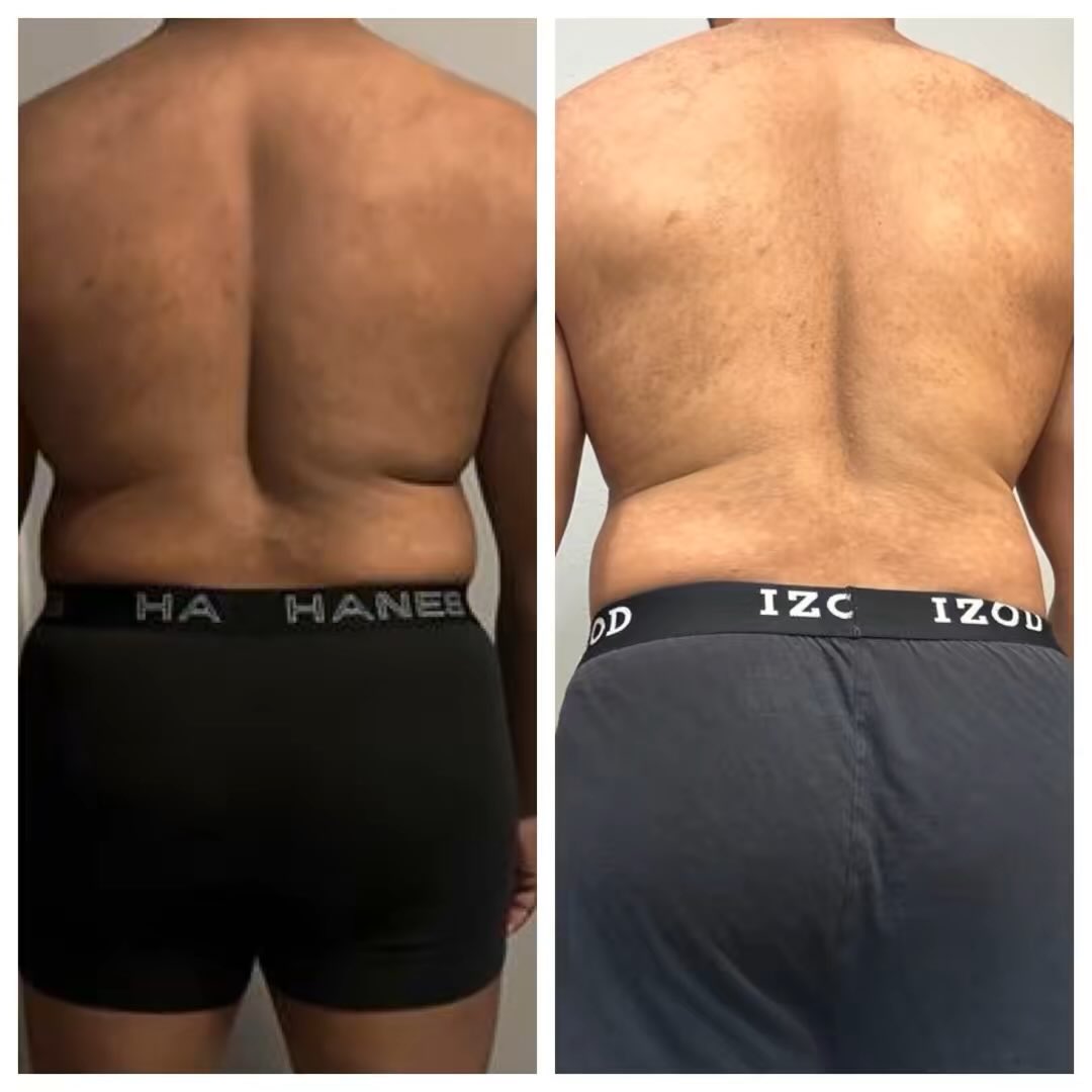 CLIENT SPOTLIGHT!!!

James is down 13lbs and MASS improvement in his stomach, which has been the area that bothers him the most. Besides his weight, BIGGEST WIN is he stopped drinking alcohol. When he first started with me, he was consuming 3-4 alcohol beverages a night!