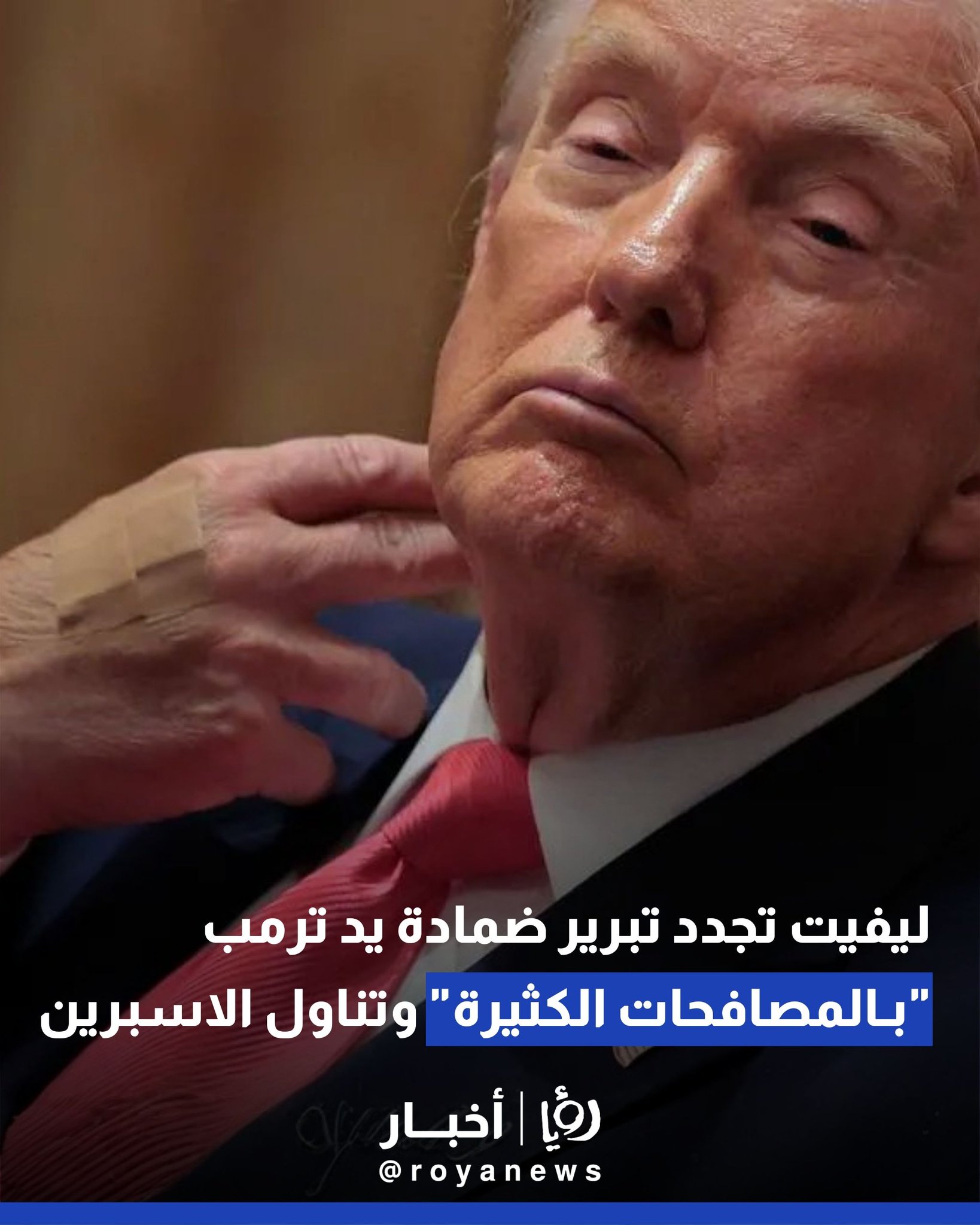 ليفيت تجدد تبرير ضمادة يد ترمب بـ "المصافحات الكثيرة" وتناول الاسبرين 