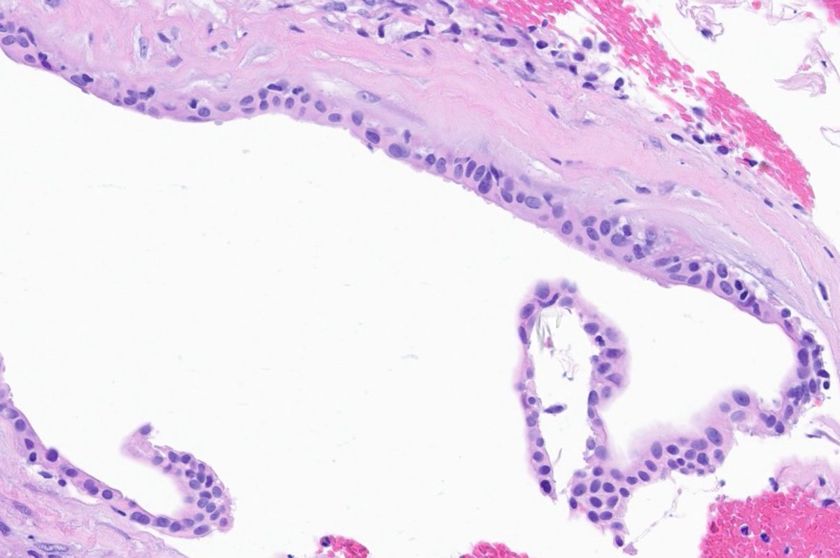 Craig Horbinski tweet media