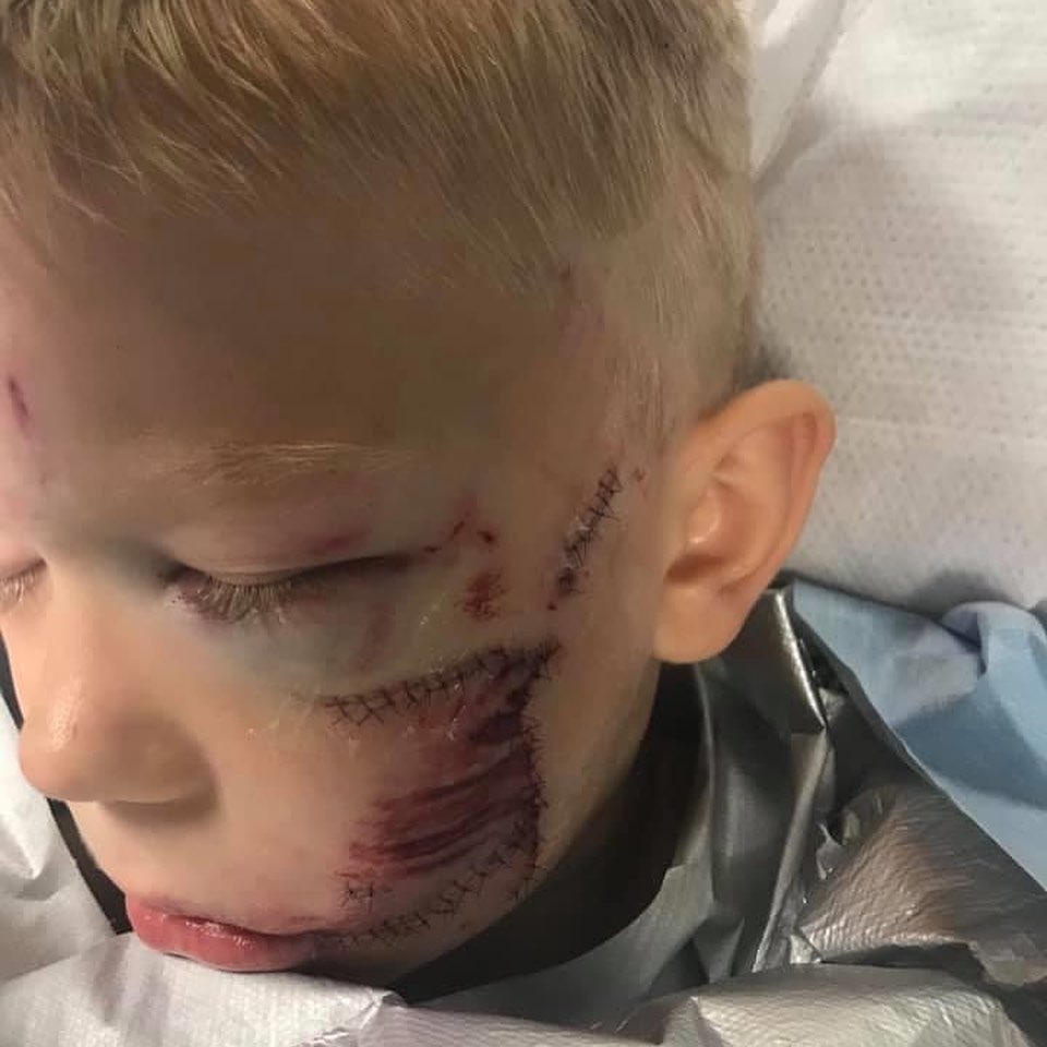 HumanityChad's tweet photo. This boy named Bridger Walker saved his little sister by standing between her and a charging dog. He said "If someone had to die, I thought it should be me" https://t.co/WIn2P9xzeW