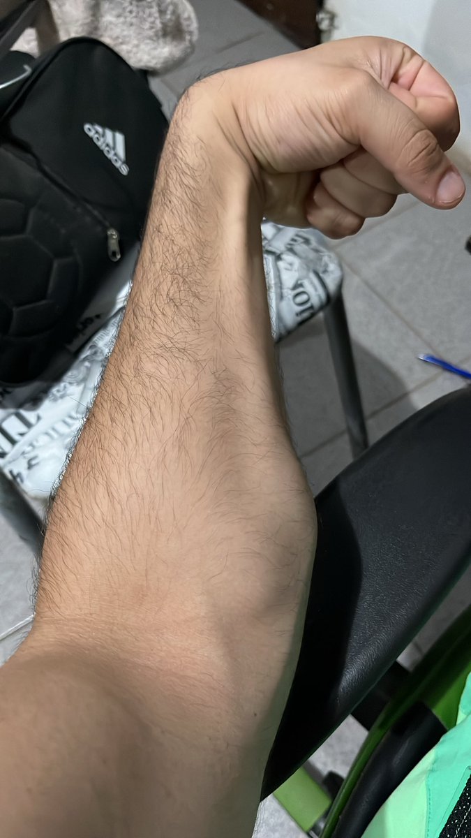Cuando tengan uno así me avisan 
Agarre de tóxica al fallo 😅