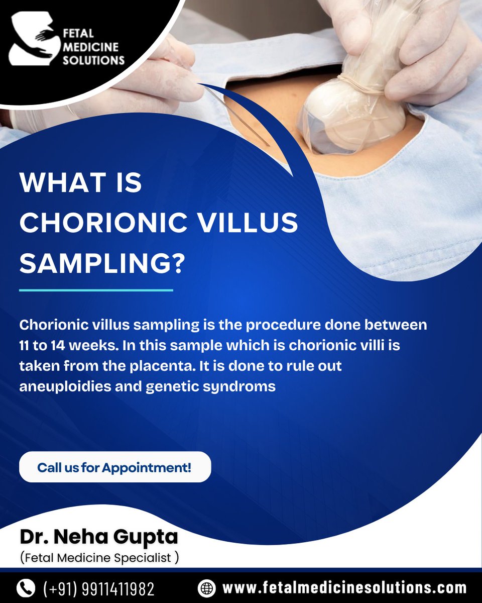 MedicineFetal's tweet image. 🔍 What is Chorionic Villus Sampling?
Chorionic villus sampling is the procedure done between 11 to 14 weeks. In this sample, chorionic villi are taken from the placenta.
-
👩‍⚕️Dr. Neha Gupta,  Fetal Medicine Specialist in Noida 
📞 +91 9911411982

#ChorionicVillusSampling #CVS