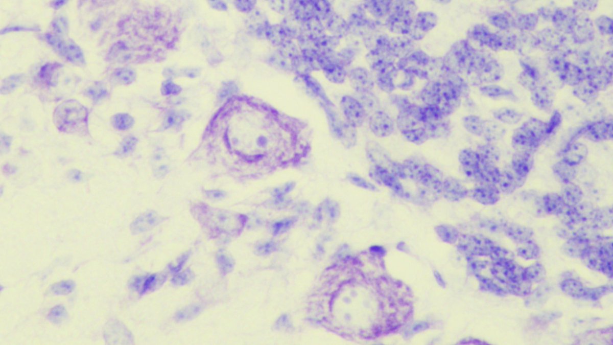 jonlg5's tweet photo. 🔬✨ This month I bring a cerebellar histology in H&amp;E and Nissl stain. #MonthCellPic 🧠A closer look at the Purkinje cells, the master integrators of cerebellar circuits. 
Gaur zerebeloaren irudia: koordinazioa, oreka &amp; ikasketa motorra fintzen dituzte Purkinje neuronek!🤸‍♀️ https://t.co/Uc9LJLC9Wk
