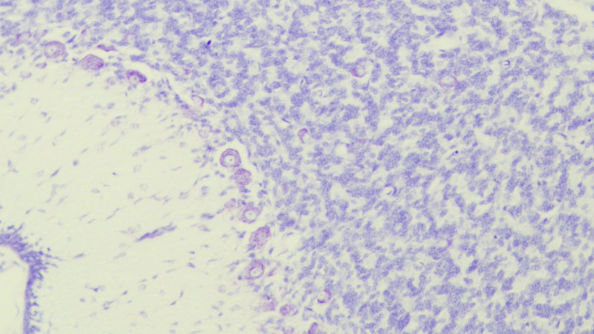 jonlg5's tweet photo. 🔬✨ This month I bring a cerebellar histology in H&amp;E and Nissl stain. #MonthCellPic 🧠A closer look at the Purkinje cells, the master integrators of cerebellar circuits. 
Gaur zerebeloaren irudia: koordinazioa, oreka &amp; ikasketa motorra fintzen dituzte Purkinje neuronek!🤸‍♀️ https://t.co/Uc9LJLC9Wk