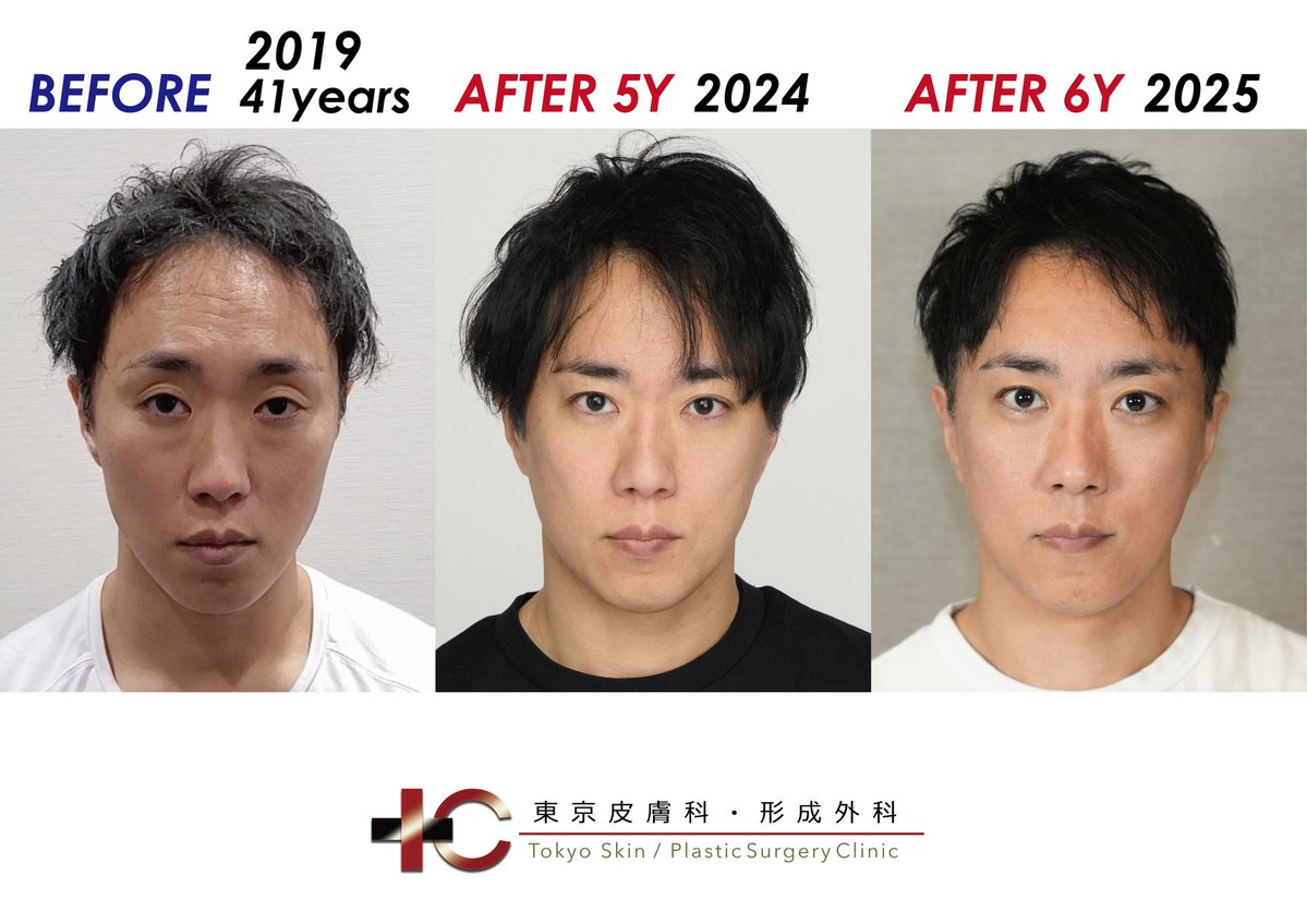 東京皮膚科・形成外科 池田欣生 Yoshio Ikeda (@ginzaikeda) / Posts / X