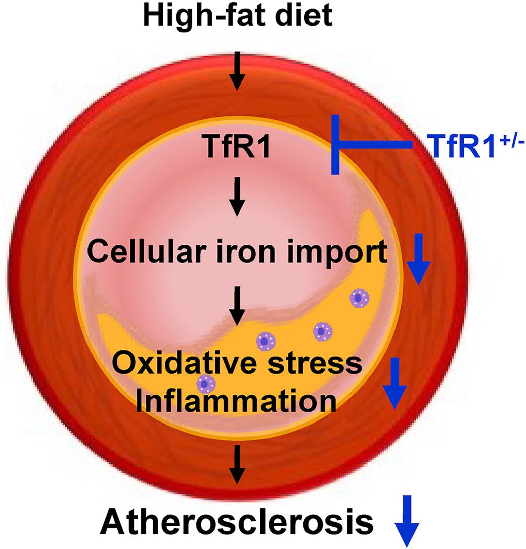 Atherosclerosis Plus tweet media