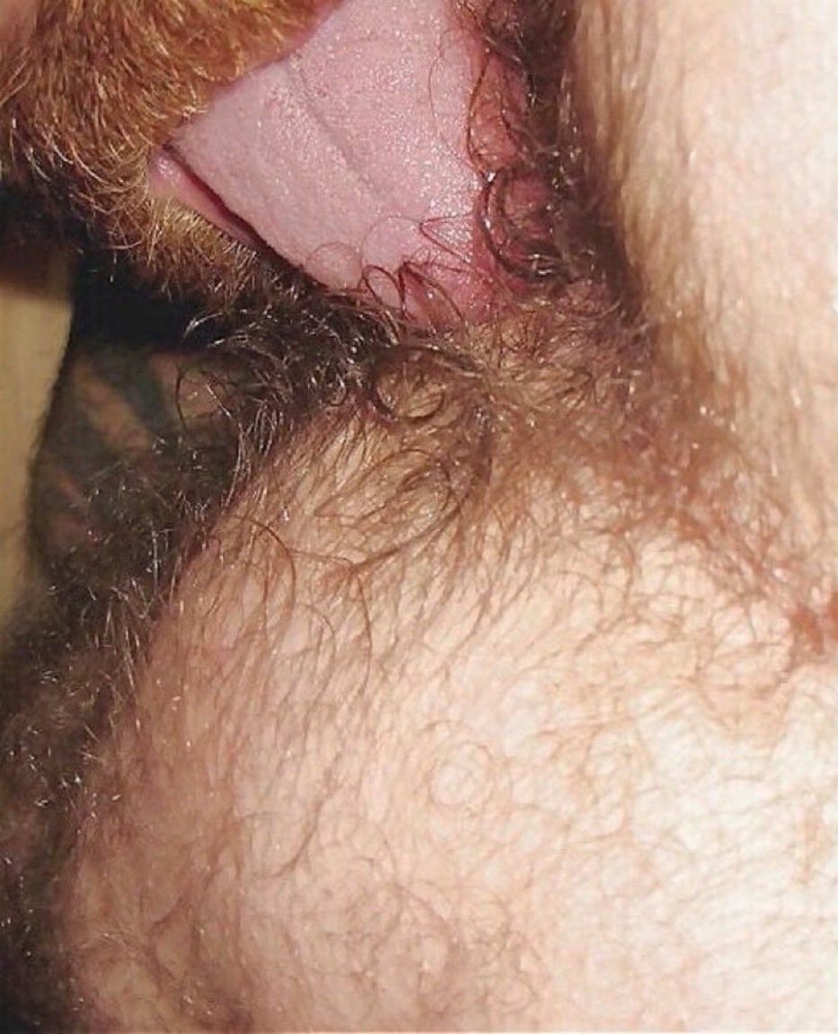 GREEDY🇦🇺RIMMER🐽👅 tweet media