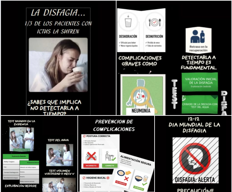Genva2022's tweet photo. ¡DÍA MUNDIAL DE LA DISFAGIA! El Riesgo que Cuesta Vidas 🔑
La #Disfagia post #Ictus ocasiona  #neumonía por aspiración asociada al 40% de mortalidad. #GENVA te ofrece:
🎥 3 videos sobre Tests disfagia 
👉 ACCEDE  https://t.co/RxnQ9mDHCL
#DíaMundialDisfagia #Disfagia #Cuidadores https://t.co/V42js4X0l2