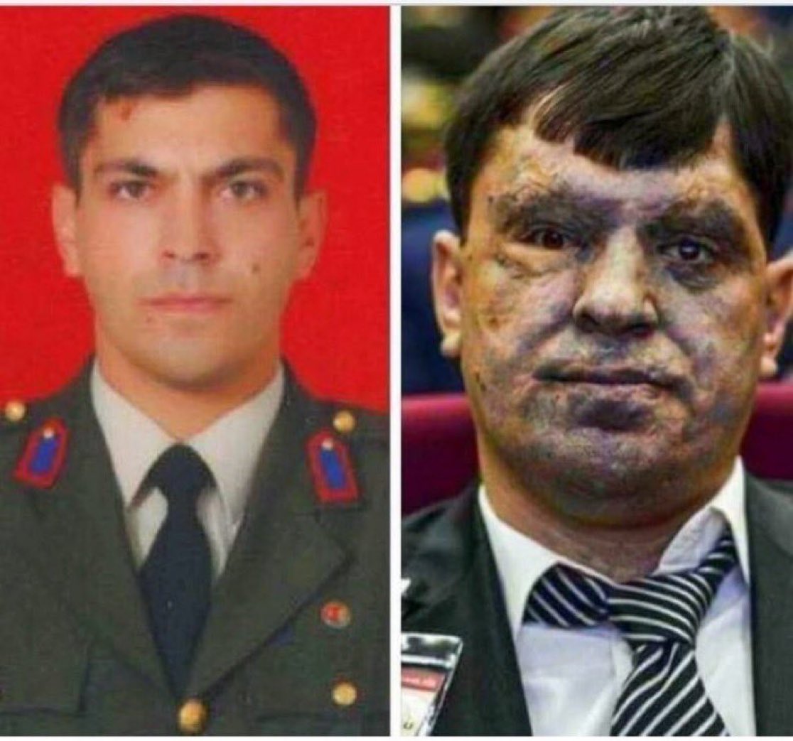 Vatan için yüzünü, gözlerini ve ellerini feda eden, Şanlı Gazimiz Binbaşı Mehmet Bedri Aluçlu.

🇹🇷Türk Ulusu size minnettardır Binbaşım!