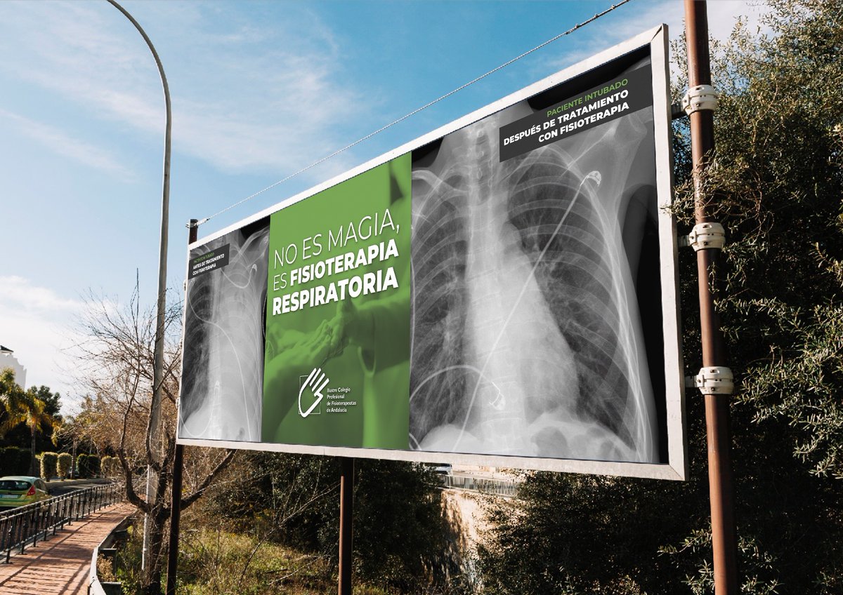 No es magia, es FISIOTERAPIA RESPIRATORIA
El Colegio de Fisioterapeutas de Andalucía pone en marcha una nueva campaña publicitaria que evidencia los beneficios de la Fisioterapia Respiratoria

Conoce aquí todos los detalles:
colfisio.org/new/693be3d2ac…
#FisioterapiaRespiratoria #UCI