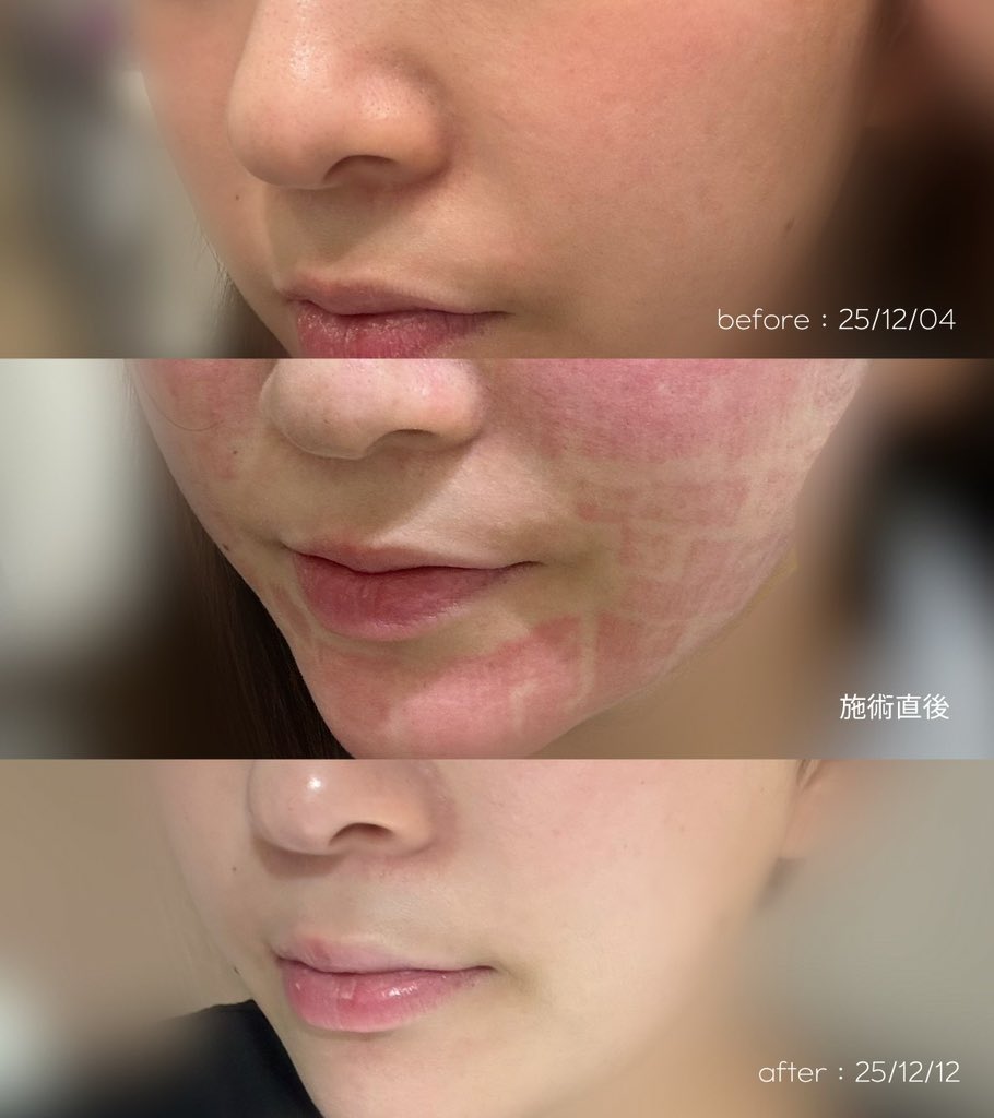 あんパン tweet media