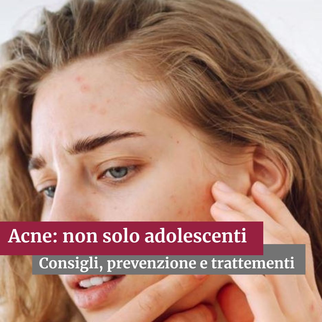 policlinicoMI's tweet image. Come si differenzia l' #acne fra adulti e adolescenti? Come si trattano e curano #macchie #brufoli e #puntineri? 
Risponde Andrea Sechi #dermatologo #PoliclinicoMi
▶️ shorturl.at/dpNEn 

#SanoASapersi