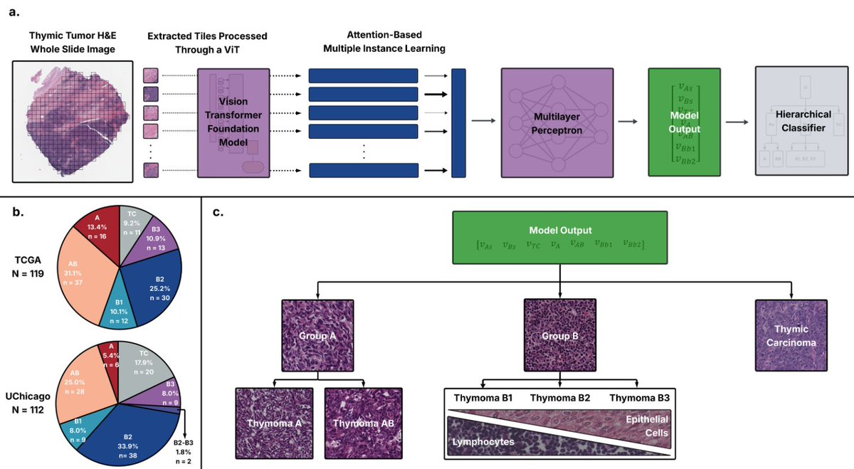 Annals_Oncology's tweet photo. 🆕Article in press: Deep learning discriminates thymic epithelial tumors histological subtypes using digital pathology

👉https://t.co/NfIFRiRGWW
@marinagarassino @eripietroluongo @matte_esse @AnnaDiLelloMD https://t.co/xhelzEgUKM