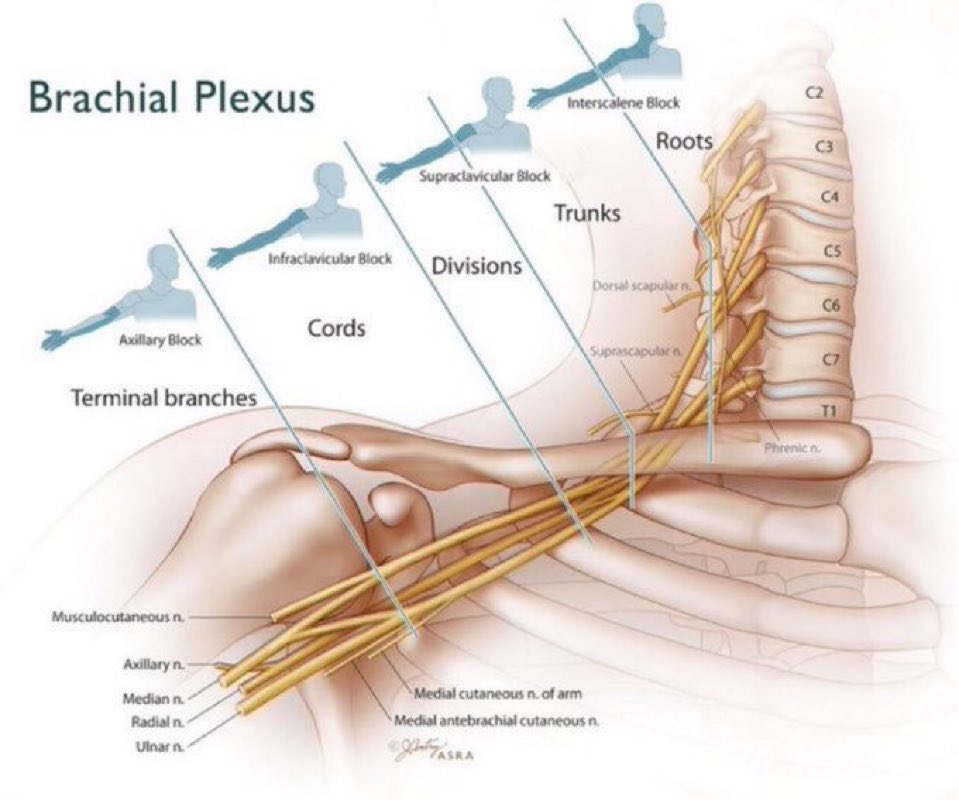 ENARM_intensivo's tweet image. 💢BRACHIAL  PLEXUS

#MEDTWITTER #MEDICALEDUCATION

📲homomedicus.com