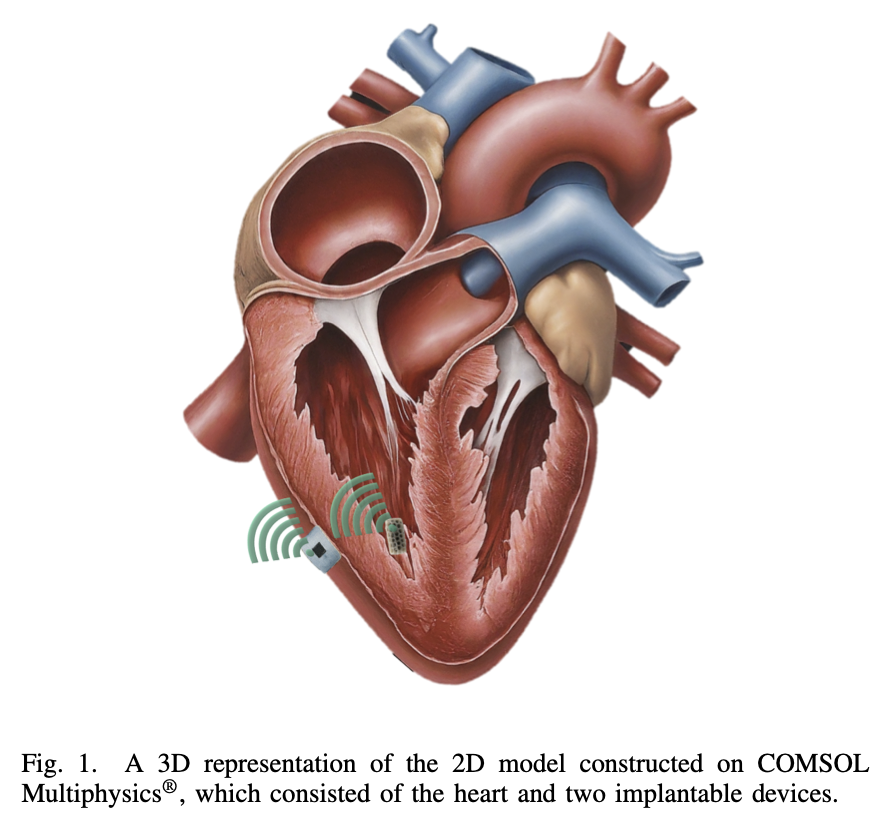 CorinneNokel's tweet image. Josep Jornet

Wireless THz Intra-Body Communication

#Aboott #Medtronic

The Potential of Terahertz Technology to
Revolutionize Cardiac Healthcare

unlab.tech/wp-content/upl…