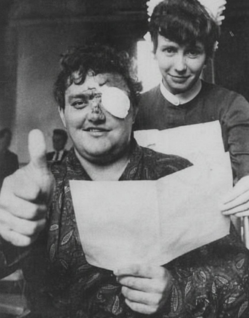 In May 1969, Colin Milburn lost his left eye in a serious car accident near Moulton, Northampton. He made a determined effort to return to cricket, even scoring a fifty for Northants at Guildford, but ultimately the challenge was too great, and he had to retire. #CricketTwitter