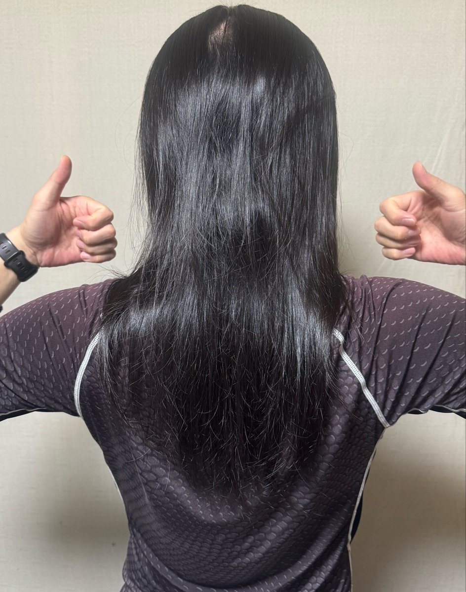 kosuke_ushino's tweet image. 丸坊主→スキンヘッド
今日で27ヶ月経過

ここまでくると、そろそろトリートメントの周期が悩みの種…

丸坊主にしたきっかけ
→Webラジオ - #45 子どもだって髪の毛を切りたくない理由はきっとあるというお話しyoutu.be/y2gpVLcyJvo

#目指せバージンヘアで100cm #hairdonation #ヘアドネーション