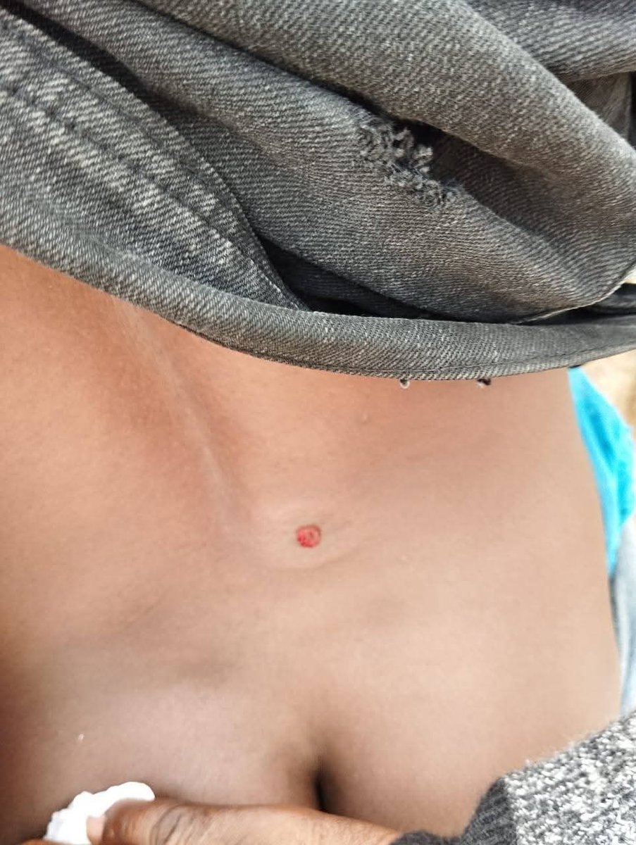 Several people suffer gunshot wounds after police fired live bullets and teargas at congregants at Kariobangi PCEA church.