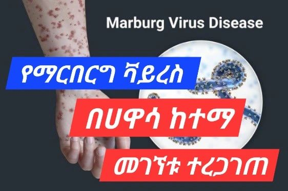 AssalifD's tweet photo. ማርበርግ ቫይረስ #በሀዋሳ_ከተማ መገኘቱ ተረጋገጧል!

ባለፈው ሳምንት አዲስ የማርበርግ ቫይረስ ህመምተኛ በሀዋሳ ከተማ መገኘቱን የጤና ሚኒስቴር አረጋግጧል። በቫይረሱ የተያዘው ሰው መጀመሪያ በጂንካ ከተያዘው ግለሰብ ጋር ቀጥተኛ ግንኙነት ነበረው https://t.co/7kMqhxvMX8